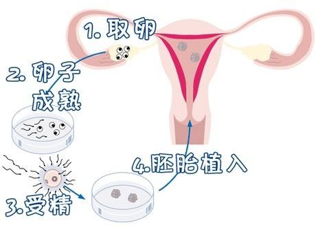 液氮库